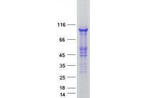 Western Blotting (WB) image for Ubiquitin Protein Ligase E3A (ube3a) (Transcript Variant 2) protein (Myc-DYKDDDDK Tag) (ABIN2734880)