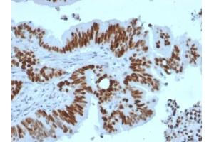 ABIN6383819 to TP53 was successfully used to stain human colon carcinoma sections. (Rekombinanter p53 Antikörper  (AA 16-25))