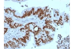 ABIN6383819 to TP53 was successfully used to stain human colon carcinoma sections.