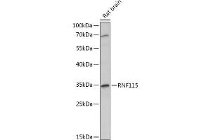 Western blot analysis of extracts of Rat brain, using RNF115 antibody (ABIN7270056) at 1:1000 dilution. (RNF115 Antikörper  (AA 30-140))