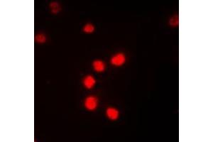 Immunofluorescent analysis of ZNF682 staining in Jurkat cells. (ZNF682 Antikörper  (N-Term))