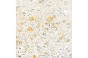 Immunohistochemistry analysis of paraffin embedded mouse cerebellum using Erc2 (ABIN7073808) at dilution of 1: 3000