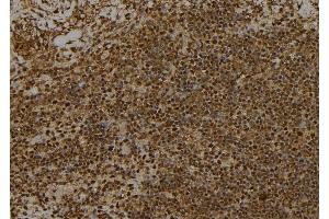 Immunohistochemistry (IHC) image for anti-Ribosomal Protein S6 Kinase, 90kDa, Polypeptide 1 (RPS6KA1) (pSer363), (pThr359) antibody (ABIN6255259)