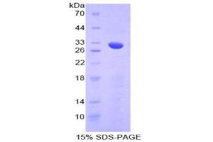 SDS-PAGE (SDS) image for Numb Homolog (NUMB) (AA 377-642) protein (His tag) (ABIN1879489)