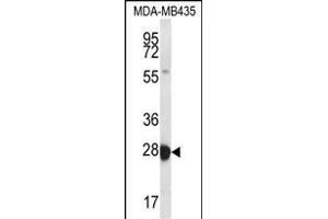 RAB27B Antibody (Center) (ABIN656670 and ABIN2845910) western blot analysis in MDA-M cell line lysates (35 μg/lane). (RAB27B Antikörper  (AA 121-150))