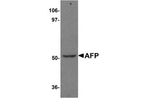 Western blot analysis of AFP in human liver tissue lysate with AFP Antibody (N-term) at 1 μg/ml. (alpha Fetoprotein Antikörper  (N-Term))