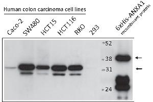 Western Blotting (WB) image for anti-Annexin A1 (ANXA1) antibody (ABIN2703590) (Annexin a1 Antikörper)