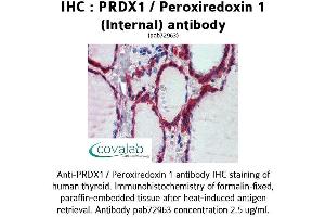Image no. 2 for anti-Peroxiredoxin 1 (PRDX1) (Internal Region) antibody (ABIN1738319) (Peroxiredoxin 1 Antikörper  (Internal Region))