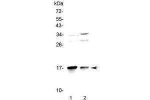 Western blot testing of 1) rat brain and 2) mouse brain lysate with LC3A antibody at 0. (MAP1LC3A Antikörper)