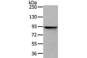 Gel: 6 % SDS-PAGE, Lysate: 40 μg, Lane: HT-29 cell, Primary antibody: ABIN7128081(VIL1 Antibody) at dilution 1/250 dilution, Secondary antibody: Goat anti rabbit IgG at 1/8000 dilution, Exposure time: 3 seconds