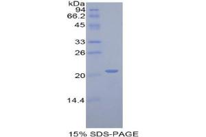 SDS-PAGE analysis of Rat ARPC4 Protein. (ARPC4 Protein)