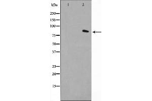 Western blot analysis on LOVO cell lysate using FAP-1 Antibody，The lane on the left is treated with the antigen-specific peptide. (FAP Antikörper  (Internal Region))
