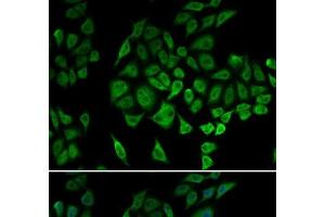Immunofluorescence analysis of U2OS cells using NDUFS1 Polyclonal Antibody (NDUFS1 Antikörper)