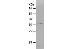 Western Blotting (WB) image for Charcot-Leyden Crystal Protein (CLC) (AA 1-142) protein (His-IF2DI Tag) (ABIN7122250) (Galectin 10 Protein (AA 1-142) (His-IF2DI Tag))