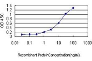 Detection limit for recombinant GST tagged CSE1L is approximately 0. (Exportin 2 Antikörper  (AA 872-971))