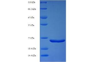 SDS-PAGE (SDS) image for Lymphocyte Antigen 6 Complex, Locus E (LY6E) (AA 21-101) protein (His-SUMO Tag) (ABIN5711281) (LY6E Protein (AA 21-101) (His-SUMO Tag))