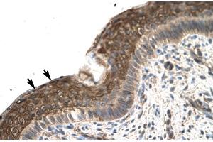 Rabbit Anti-ZFP1 Antibody Catalog Number: ARP31586 Paraffin Embedded Tissue: Human Spermatophore Cellular Data: Epithelial cells Antibody Concentration: 4. (Zfp-1 Antikörper  (N-Term))