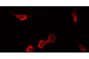 ABIN6267548 staining Hela by IF/ICC. (CCR5 Antikörper  (pSer336))
