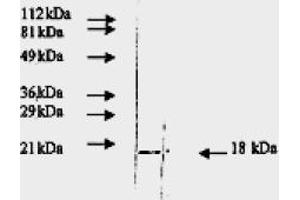 Western Blotting (WB) image for anti-Fibroblast Growth Factor 2 (Basic) (FGF2) antibody (ABIN452472) (FGF2 Antikörper)