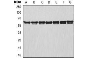 Western blot analysis of TRAF3 expression in MCF7 (A), HeLa (B), Raji (C), NIH3T3 (D), mouse lung (E), rat colon (F), PC12 (G) whole cell lysates. (TRAF3 Antikörper  (Center))