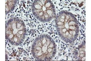 Image no. 7 for anti-Chromosome 2 Open Reading Frame 62 (C2orf62) antibody (ABIN1497054) (C2orf62 Antikörper)