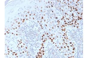 Formalin-fixed, paraffin-embedded Cervix stained with p40 Rabbit Polyclonal Antibody. (p63 Antikörper)