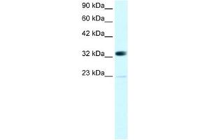 WB Suggested Anti-CBX4 Antibody Titration: 0. (CBX4 Antikörper  (N-Term))