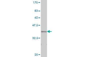 Western Blotting (WB) image for anti-Integrin alpha 2 (ITGA2) (AA 30-119) antibody (ABIN561540)