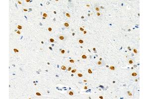 ABIN6257236 and ABIN6275800 at 1/100 staining Rat brain tissue by IHC-P. (GATA6 Antikörper  (Internal Region))