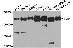 Western blot analysis of extracts of various cell lines, using TOP1 antibody. (Topoisomerase I Antikörper  (AA 1-100))