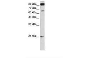 Image no. 2 for anti-Nuclear Factor of Activated T-Cells, Cytoplasmic, Calcineurin-Dependent 4 (NFATC4) (AA 601-650) antibody (ABIN202948)