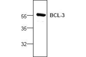 Image no. 1 for anti-B-Cell CLL/lymphoma 3 (BCL3) antibody (ABIN127088) (BCL3 Antikörper)