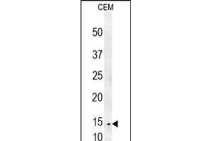 CRCT1 Antibody (N-term) (ABIN653986 and ABIN2843928) western blot analysis in CEM cell line lysates (35 μg/lane). (CRCT1 Antikörper  (N-Term))