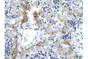 Rabbit Anti-TOP2A antibody  AV Paraffin Embedded Tissue: Human Liver cell Cellular Data: hepatocyte of renal tubule Antibody Concentration: 4. (Topoisomerase II alpha Antikörper  (C-Term))