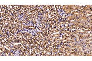 Detection of NME2 in Mouse Kidney Tissue using Polyclonal Antibody to Non Metastatic Cells 2, Protein NM23B Expressed In (NME2) (NME2 Antikörper  (AA 8-149))