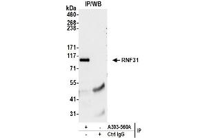 Immunoprecipitation (IP) image for anti-Ring Finger Protein 31 (RNF31) (AA 1022-1072) antibody (ABIN7449808)