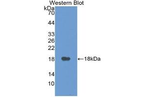Western blot analysis of the recombinant protein. (VEGFA Antikörper  (AA 27-145))