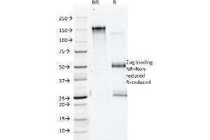 SDS-PAGE Analysis Purified Annexin A1 Mouse Monoclonal Antibody (ANEX 5E4/1). (Annexin a1 Antikörper)
