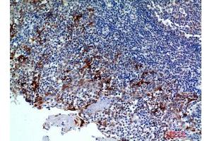 Immunohistochemistry (IHC) analysis of paraffin-embedded Human Tonsils2, antibody was diluted at 1:100. (CMTM8 Antikörper)