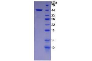 SDS-PAGE analysis of Rat Cholecystokinin Protein.