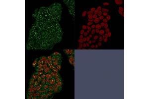 Immunofluorescence Analysis of MCF-7 cells using Mammaglobin Recombinant Rabbit Monoclonal Antibody (MGB/2682R) followed by goat anti-mouse IgG-CF488, counterstained with RedDot.