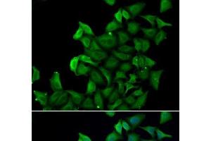 Immunofluorescence analysis of A549 cells using FABP5 Polyclonal Antibody (FABP5 Antikörper)