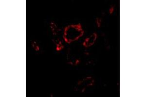 Immunofluorescence of SNAI2 in human kidney tissue with SNAI2 polyclonal antibody  at 20 ug/mL . (SLUG Antikörper  (Internal Region))