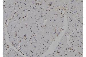 ABIN6262652 and ABIN6277154 at 1/100 staining Human gastric tissue by IHC-P. (IRF3 Antikörper  (C-Term))
