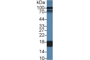 Western Blot; Sample: Porcine Liver lysate; Primary Ab: 1µg/ml Rabbit Anti-Porcine FABP1 Antibody Second Ab: 0. (FABP1 Antikörper  (AA 1-127))