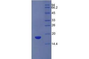 SDS-PAGE (SDS) image for Solute Carrier Family 3 (Activators of Dibasic and Neutral Amino Acid Transport), Member 2 (SLC3A2) ELISA Kit (ABIN6720502)