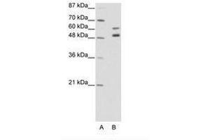 Image no. 1 for anti-Zinc Finger Protein 682 (ZNF682) (AA 35-84) antibody (ABIN202663) (ZNF682 Antikörper  (AA 35-84))