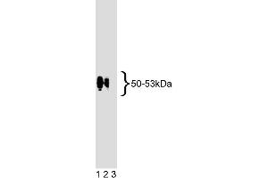 Western blot analysis of EBP50 on human endothelial cell lysate. (SLC9A3R1 Antikörper  (AA 128-249))