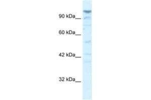 Western Blotting (WB) image for anti-La Ribonucleoprotein Domain Family, Member 1B (LARP1B) antibody (ABIN2460977)