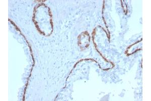 Immunohistochemistry (IHC) image for anti-Keratin 15 (KRT15) antibody (ABIN6939914)